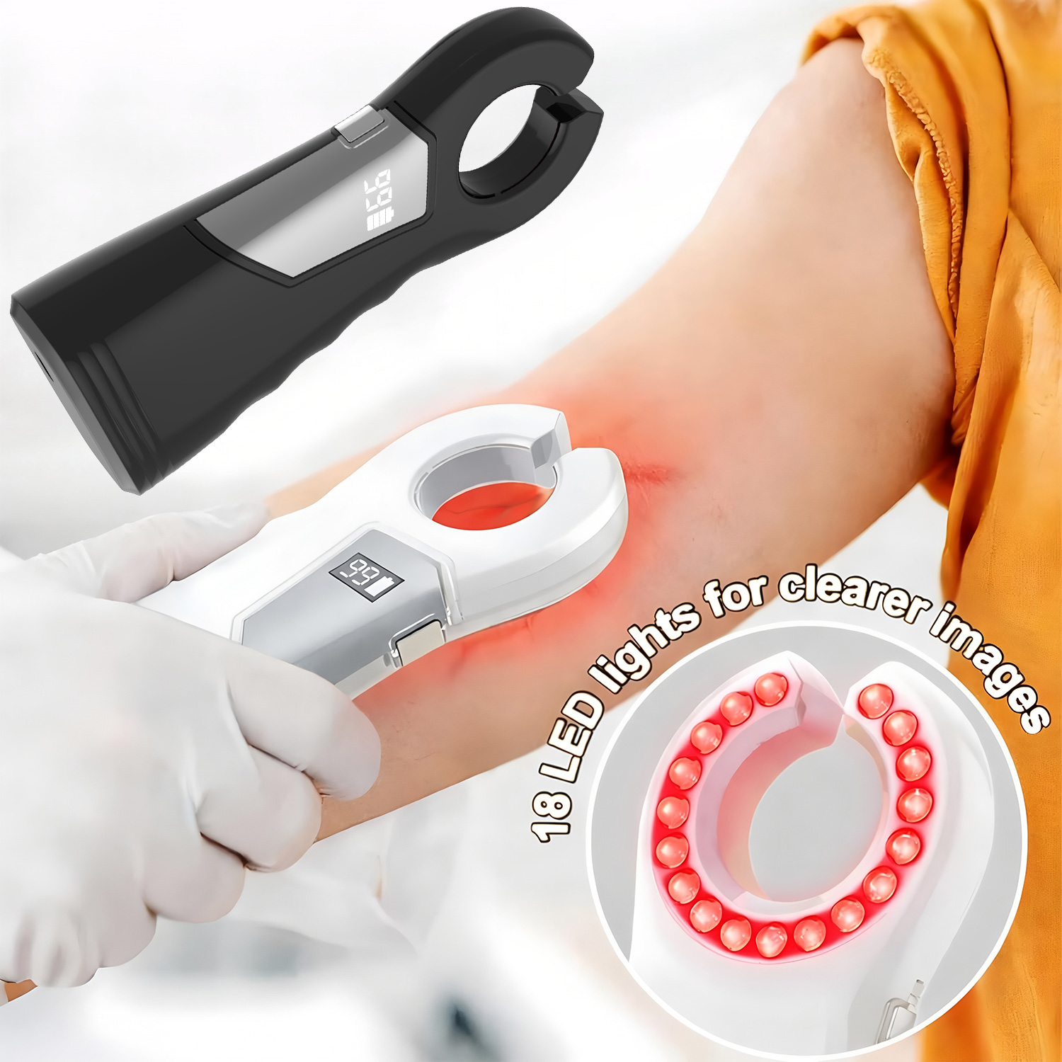 Medical Infrared Vein Locator  – обзор и цена Medical Laboratory Science